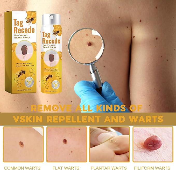 Bee Venom Wart Remover Spray (Pack of 2)